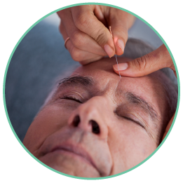 image 1 acupuncture