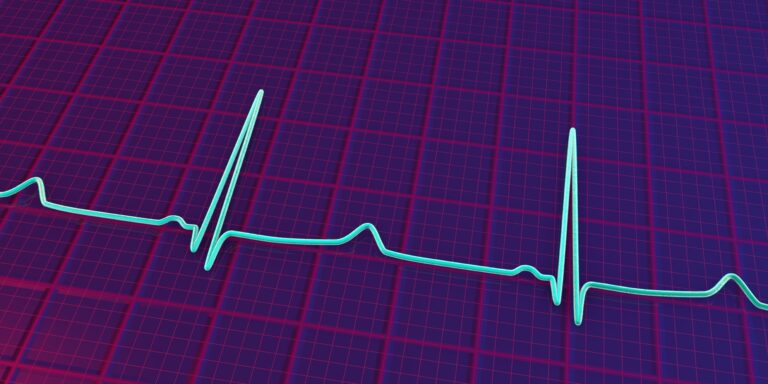 Drug-induced QT Prolongation: A Review