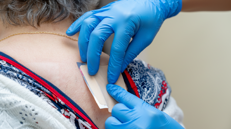 Comparing Prescription and Over-the-counter Lidocaine Patches