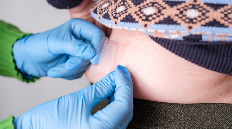 Transdermal Fentanyl: Conversion Considerations and Use in Patients with Cachexia